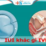 IUI khác gì IVF? Đâu là kỹ thuật hỗ trợ sinh sản hàng đầu