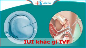 IUI khác gì IVF? Đâu là kỹ thuật hỗ trợ sinh sản hàng đầu