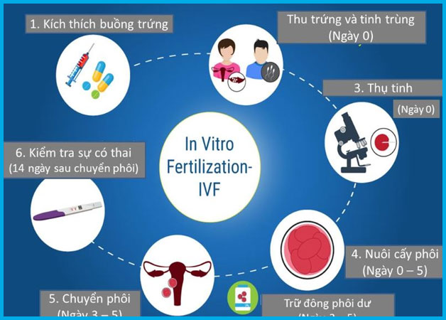 Các bước thực hiện cơ bản trong IVF