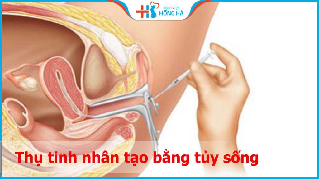 Thụ tinh nhân tạo bằng tủy sống bao lâu nữa có thể áp dụng