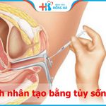 Thụ tinh nhân tạo bằng tủy sống bao lâu nữa có thể áp dụng