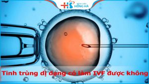 Tinh trùng dị dạng có làm IVF được không và một số lưu ý quan trọng