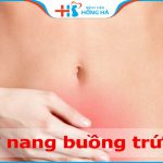 Tình trạng vỡ nang buồng trứng: Nguyên nhân, triệu chứng và điều trị