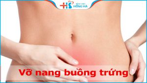 Tình trạng vỡ nang buồng trứng: Nguyên nhân, triệu chứng và điều trị