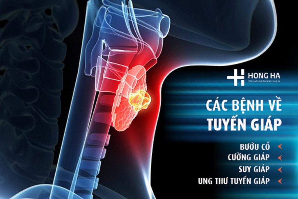 Những bệnh thường gặp về tuyến giáp