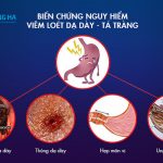 Những Biến Chứng Nguy Hiểm của Bệnh Viêm Loét Dạ Dày