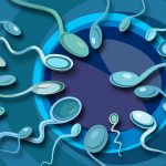 Chỉ điểm nguyên nhân vô sinh thứ phát ở cả nam và nữ