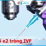 Chỉ số e2 trong IVF là gì? Thông số bao nhiêu thì bình thường