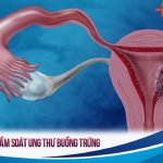 Gói tầm soát ung thư buồng trứng