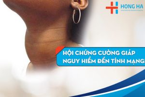 Nguy hiểm biến chứng bệnh cường giáp: Điều trị cách nào?