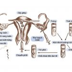 Quy trình thụ tinh ống nghiệm và những lưu ý cần biết