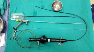 Tán sỏi nội soi ngược dòng công nghệ LASER