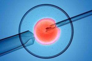 Thụ tinh trong ống nghiệm có tốt không? Tại sao IVF trở nên an toàn nhất