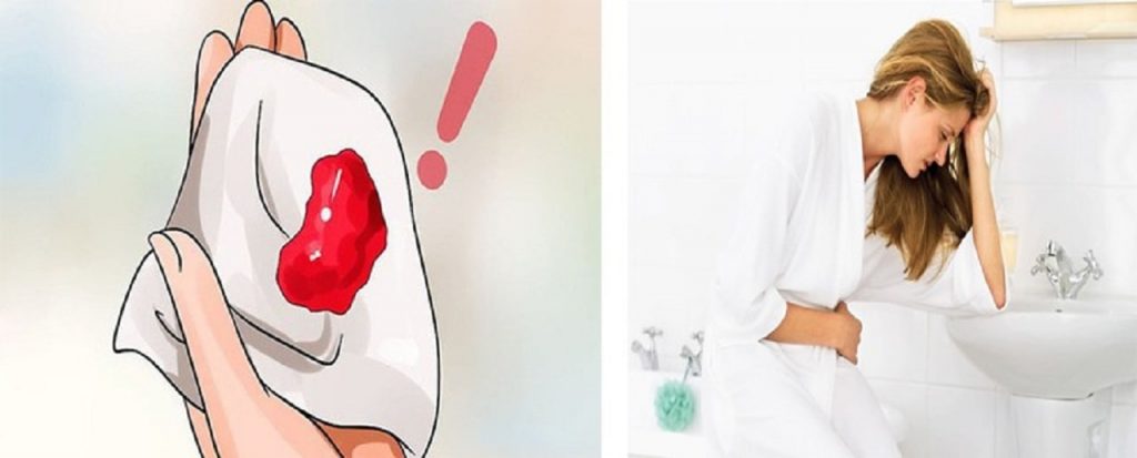 Tổng hợp các nguyên nhân phổ biến gây vô sinh ở phụ nữ
