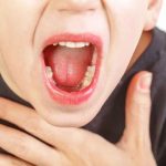 Viêm V.A : Dấu hiệu, nguyên nhân và phương pháp điều trị