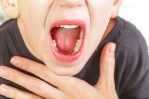 Viêm V.A : Dấu hiệu, nguyên nhân và phương pháp điều trị