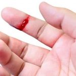 Máu báo thai xuất hiện trong thai kỳ: Thời gian, nguyên nhân và cách xử lý
