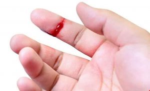 Máu báo thai xuất hiện trong thai kỳ: Thời gian, nguyên nhân và cách xử lý