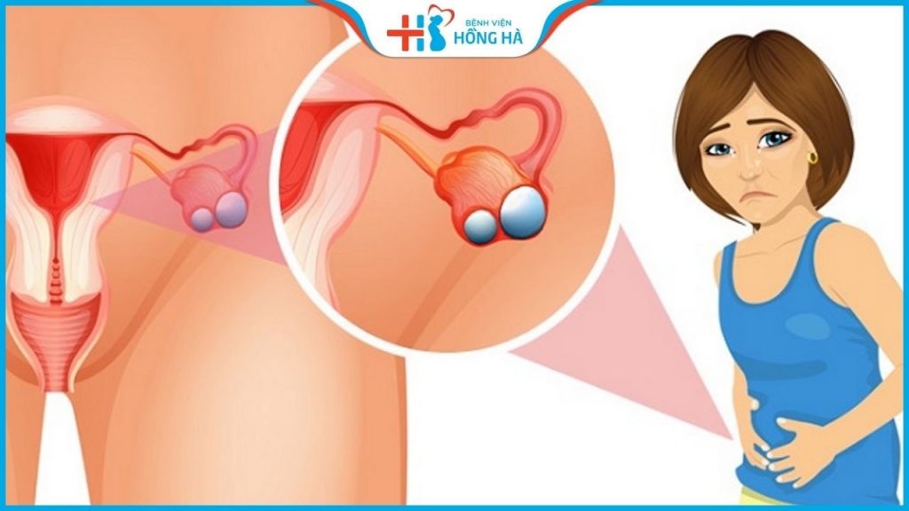 AMH thấp có làm IVF được không? 5 lưu ý giúp tăng chỉ số AMH