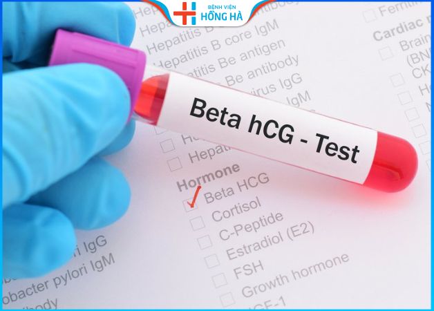 Xét nghiệm nồng độ beta hCG để kiểm tra việc mang thai