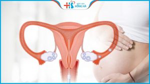 5 điều cần làm sau khi bơm tinh trùng giúp giữ thai khỏe mạnh