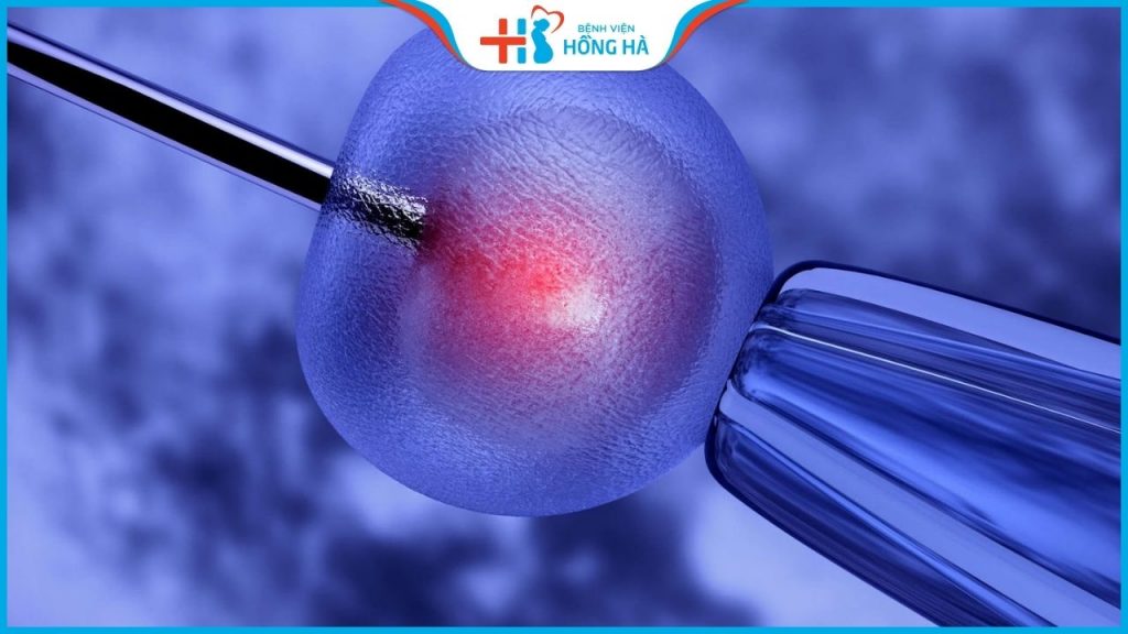 Điều kiện để thụ tinh nhân tạo là gì? Đâu là điều kiện bắt buộc