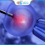 Điều kiện để thụ tinh nhân tạo là gì? Đâu là điều kiện bắt buộc