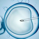 IUI là gì? Quy trình thụ tinh nhân tạo IUI như thế nào?