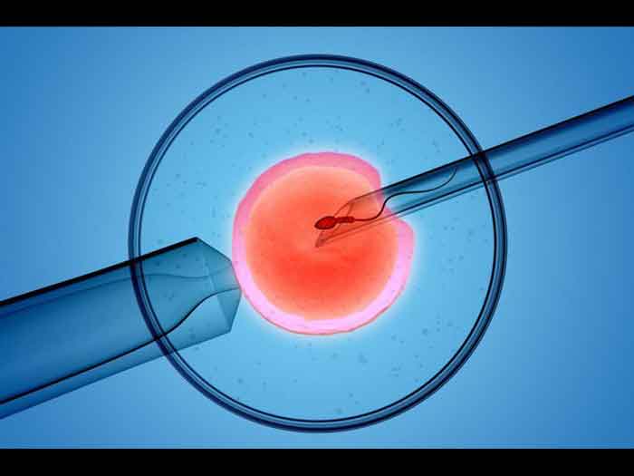 Làm IVF- thụ tinh nhân tạo không gây đau đớn
