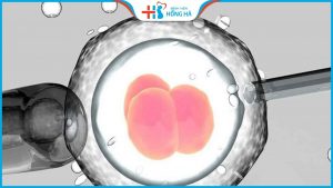 Những nguyên nhân IVF thất bại khiến nhiều phụ nữ thất vọng