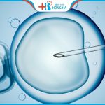 Thụ tinh trong ống nghiệm là gì? quy trình thực hiện ivf diễn ra như thế nào