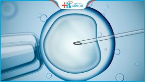 Thụ tinh trong ống nghiệm là gì? quy trình thực hiện ivf diễn ra như thế nào