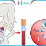 Xét nghiệm NIPT là gì? Thực hiện xét nghiệm nipt có chính xác không?