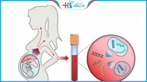 Xét nghiệm NIPT là gì? Thực hiện xét nghiệm nipt có chính xác không?
