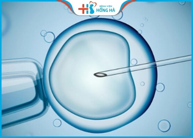 Các phương pháp hỗ trợ sinh sản như IVF mang lại hiệu quả cao
