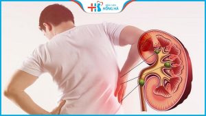 Thận yếu có gây vô sinh? Làm thế nào để cải thiện yếu thận