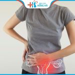 Viêm cổ tử cung mạn tính là gì? Hướng điều trị hiệu quả nhất