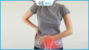 Viêm cổ tử cung mạn tính là gì? Hướng điều trị hiệu quả nhất