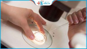 Quy trình các bước làm IVF tiêu chuẩn quyết định tỷ lệ thành công