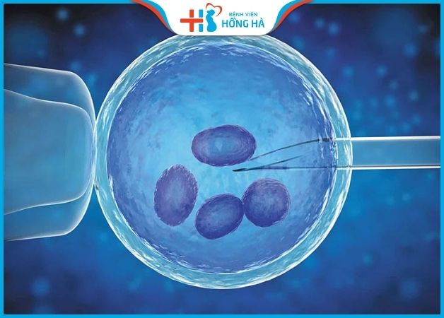 Điều trị hiếm muộn với phương pháp tiêm tinh trùng vào bào tương trứng