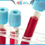 Hỏi đáp: Khi nào nên làm thụ tinh ống nghiệm?