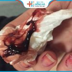 Những ảnh hưởng của kinh nguyệt màu đen tới sức khỏe sinh sản