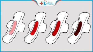 Những nguyên nhân gây ra kinh nguyệt màu đen và cách điều trị hiệu quả