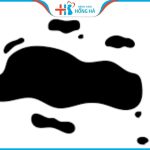 Kinh nguyệt màu đen vón cục: Nguyên nhân và cách điều trị hiệu quả