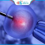 Lưu ý khi thụ tinh nhân tạo giúp nhanh đậu thai