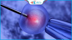 Lưu ý khi thụ tinh nhân tạo giúp nhanh đậu thai