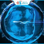 Thời gian cần thiết để thực hiện phương pháp IVF hiệu quả