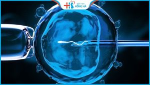 Thời gian cần thiết để thực hiện phương pháp IVF hiệu quả