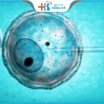 5 yếu tố giúp tăng tỷ lệ thành công khi thụ tinh ống nghiệm