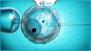 5 yếu tố giúp tăng tỷ lệ thành công khi thụ tinh ống nghiệm